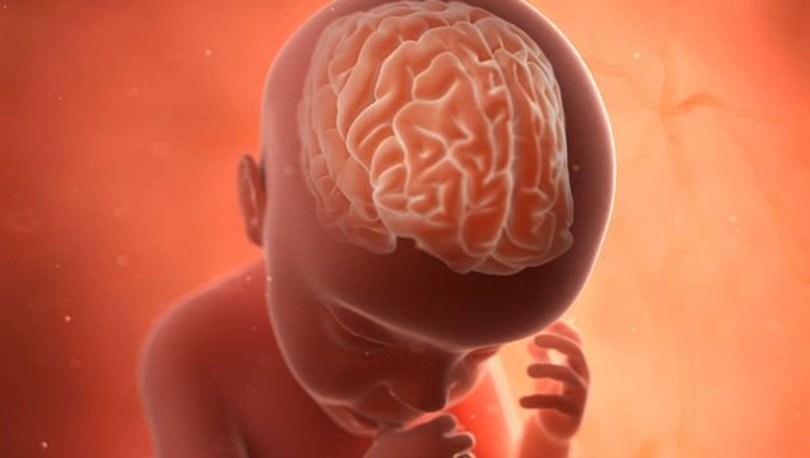 PALSY CEREBRAL